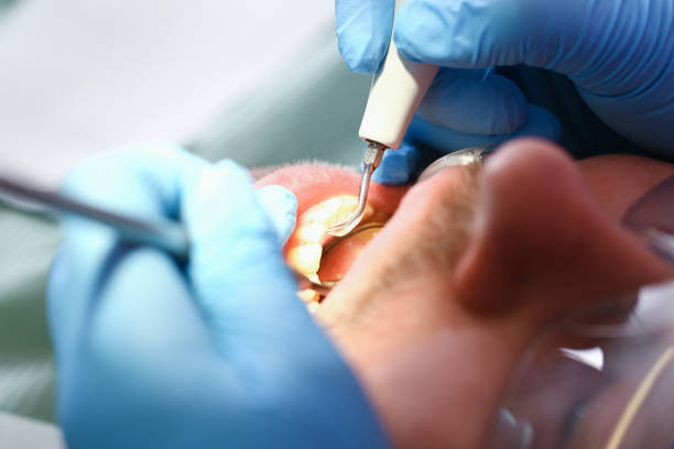 Best Walk-In Emergency Dental Services in Keokuk, IA